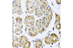 Immunohistochemistry of paraffin-embedded human stomach using TAF15 antibody.