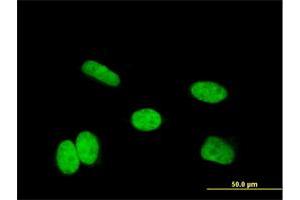 Immunofluorescence of monoclonal antibody to HOXA11 on HeLa cell. (Homeobox A11 anticorps  (AA 60-166))