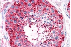 Human Testis: Formalin-Fixed, Paraffin-Embedded (FFPE) (ADAM20 anticorps  (Internal Region))