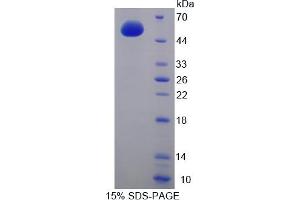 Image no. 1 for Adenylate Cyclase 9 (ADCY9) (AA 852-1065) protein (His tag,GST tag) (ABIN6238255)