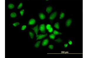 Immunofluorescence of purified MaxPab antibody to DDX20 on HeLa cell. (DDX20 anticorps  (AA 1-824))