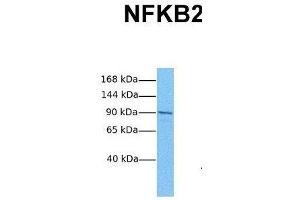 Host:  Rabbit  Target Name:  NFKB2  Sample Tissue:  Human HCT116  Antibody Dilution:  1.