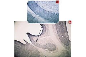 Expression of TRPC3 in mouse cerebellum - Immunohistochemical staining of mouse cerebellum using Anti-TRPC3 Antibody (ABIN7043820, ABIN7043966 and ABIN7043967) (A).