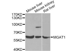 Western blot analysis of extracts of various cell lines, using MGAT1 Antibody (ABIN5975025) at 1/1000 dilution. (MGAT1 anticorps)