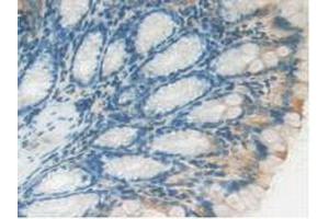 IHC-P analysis of Mouse Intestine Tissue, with DAB staining. (LAMP2 anticorps  (AA 295-410))