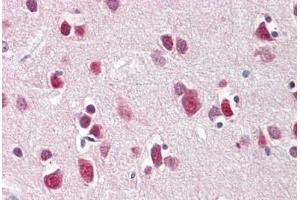 Human Brain, Cortex: Formalin-Fixed, Paraffin-Embedded (FFPE)