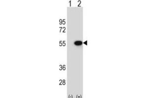 Western Blotting (WB) image for anti-Reptin,TIP49B,RUVB2 antibody (ABIN2995224) (Reptin,TIP49B,RUVB2 anticorps)