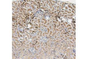 IHC analysis of GUSB using anti-GUSB antibody (ABIN7599854).