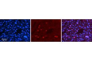 Rabbit Anti-ZNF3 Antibody      Formalin Fixed Paraffin Embedded Tissue: Human Adult Liver   Observed Staining: Nuclear in hepatocytes, moderate signal, low tissue distribution  Primary Antibody Concentration: 1:100  Secondary Antibody: Donkey anti-Rabbit-Cy3  Secondary Antibody Concentration: 1:200  Magnification: 20X  Exposure Time: 0.