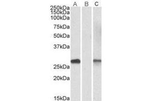 Western Blotting (WB) image for anti-DPY30 Domain Containing 1 (DYDC1) (Internal Region) antibody (ABIN2464597) (DYDC1 anticorps  (Internal Region))