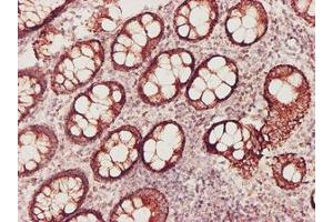 Image no. 2 for anti-Glutathione Synthetase (GSS) antibody (ABIN599380) (Glutathione Synthetase anticorps)