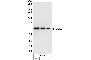 anti-DEAD (Asp-Glu-Ala-Asp) Box Polypeptide 21 (DDX21) (C-Term) antibody