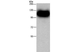 Western Blot analysis of Mouse brain tissue using MAG Polyclonal Antibody at dilution of 1:450 (MAG anticorps)