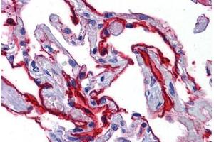 Human Lung: Formalin-Fixed, Paraffin-Embedded (FFPE) (SCUBE2 anticorps  (Internal Region))