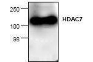 Image no. 1 for anti-Histone Deacetylase 7 (HDAC7) antibody (ABIN127244) (HDAC7 anticorps)