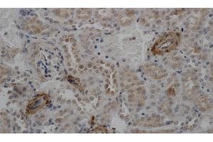 Immunohistochemistry of paraffin-embedded Mouse kidney using ACTA2 Polyclonal Antibody at dilution of 1:50 (Smooth Muscle Actin anticorps)
