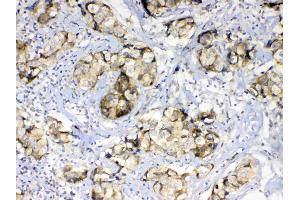 IHC analysis of GALE using anti-GALE antibody . (GALE anticorps  (AA 1-340))