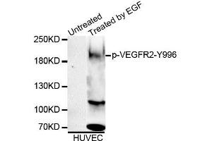 Western blot analysis of extracts of HUVEC cell line, using Phospho-VEGFR2-Y996 antibody (ABIN5995624). (VEGFR2/CD309 anticorps  (pTyr996))