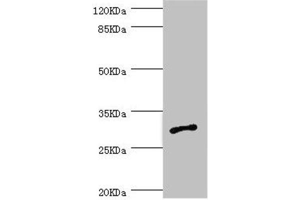AGPAT2 anticorps  (AA 199-278)