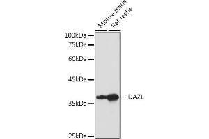 Western blot analysis of extracts of various cell lines, using DAZL antibody (ABIN6130243, ABIN6139416, ABIN6139417 and ABIN6218163) at 1:1000 dilution. (DAZL anticorps  (AA 186-295))