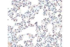 Immunohistochemistry of paraffin-embedded Rat lung using TXN Polyclonal Antibody at dilution of 1:100 (40x lens). (TXN anticorps)
