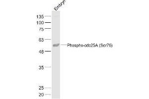 Mouse Embryo lysates probed with Phospho-cdc25A (Ser76) Polyclonal Antibody, Unconjugated  at 1:500 dilution and 4˚C overnight incubation.