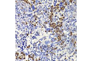 Immunohistochemistry of paraffin-embedded rat spleen using IL21 antibody (ABIN5974360) at dilution of 1/100 (40x lens). (IL-21 anticorps)