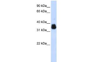 WB Suggested Anti-SCYE1 Antibody Titration:  0. (AIMP1 anticorps  (Middle Region))