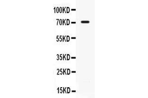 Western blot analysis of IL7R alpha expression in 22RV1 whole cell lysates ( Lane 1). (IL7R anticorps  (C-Term))