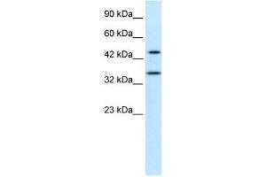 Human Jurkat; WB Suggested Anti-PNMA1 Antibody Titration: 0. (PNMA1 anticorps  (Middle Region))