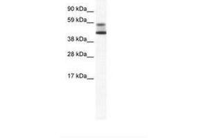 Image no. 1 for anti-Zinc Finger and BTB Domain Containing 7A (ZBTB7A) (AA 114-163) antibody (ABIN202736) (ZBTB7A anticorps  (AA 114-163))