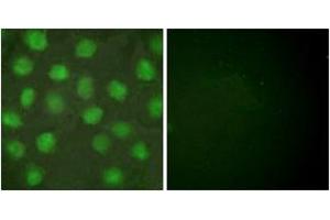 Immunofluorescence analysis of HuvEc cells, using Retinoid X Receptor gamma Antibody. (Retinoid X Receptor gamma anticorps  (AA 171-220))