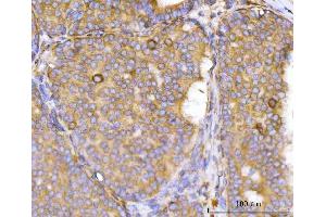 IHC analysis of Eg5/KIF11 using anti-Eg5/KIF11 antibody (ABIN7600277).