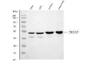 Western blot analysis of TRIP/TRAIP using anti-TRIP/TRAIP antibody (ABIN7599419). (TRAIP anticorps  (AA 1-469))
