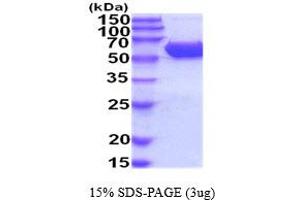 SDS-PAGE (SDS) image for Carboxylesterase 2E (CES2E) (AA 27-559) (Active) protein (His tag) (ABIN5854477)