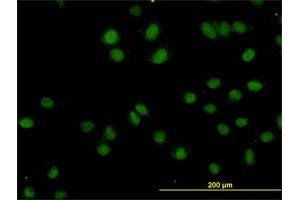 Immunofluorescence of monoclonal antibody to TOPORS on HeLa cell. (TOPORS anticorps  (AA 98-205))