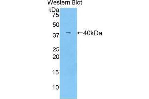 Western Blotting (WB) image for anti-Complement Component C7 (C7) (AA 725-838) antibody (ABIN1858199) (C7 anticorps  (AA 725-838))