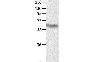 Western Blot analysis of Huamn fetal brain tissue using CRMP3 Polyclonal Antibody at dilution of 1:500 (DPYSL4 anticorps)