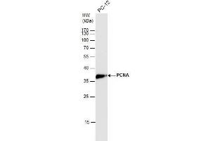 WB Image PCNA antibody detects PCNA protein by western blot analysis. (PCNA anticorps)