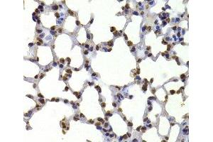 Immunohistochemistry of paraffin-embedded Mouse lung using CBX5 Polyclonal Antibody at dilution of 1:100 (40x lens). (CBX5 anticorps)