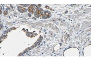 ABIN6275122 at 1/100 staining Human prostate tissue by IHC-P. (EIF3D anticorps  (Internal Region))