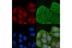ABIN6261305 and ABIN6276929 staining Hela cells by IF/ICC. (DKC1 anticorps  (Internal Region))
