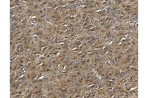 IHC analysis of ALDH1L1 using anti-ALDH1L1 antibody (ABIN7601093). (ALDH1L1 anticorps  (AA 282-424))