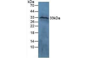 Detection of CTGF in Ovine Brain Tissue using Polyclonal Antibody to Connective Tissue Growth Factor (CTGF)