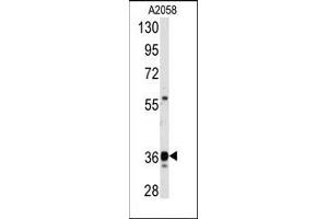 Image no. 1 for anti-Glyceraldehyde-3-Phosphate Dehydrogenase (GAPDH) (C-Term) antibody (ABIN360237) (GAPDH anticorps  (C-Term))