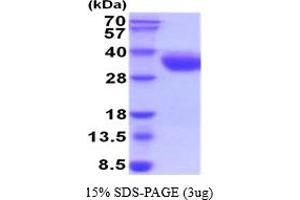 SDS-PAGE (SDS) image for SLAM Family Member 7 (SLAMF7) (AA 23-226) protein (His tag) (ABIN5854459)