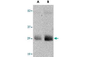 Western blot analysis of GBAS in human skeletal muscle tissue lysate with GBAS polyclonal antibody  at (A) 0. (GBAS anticorps  (N-Term))