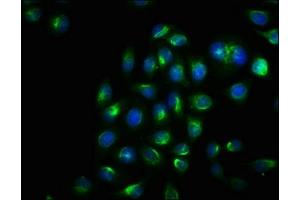Immunofluorescence staining of Hela cells with ABIN7127692 at 1:100, counter-stained with DAPI. (Recombinant ERN1 anticorps  (pSer724))