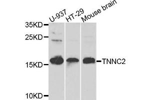 Western blot analysis of extracts of various cells, using TNNC2 antibody. (TNNC2 anticorps)