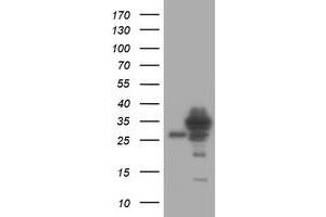 Image no. 1 for anti-Signal Recognition Particle Receptor, B Subunit (SRPRB) antibody (ABIN1501129) (SRPRB anticorps)